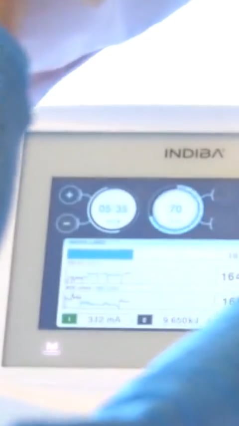 Elite NS - RF Device for Diverse Medical Applications | INDIBA Group